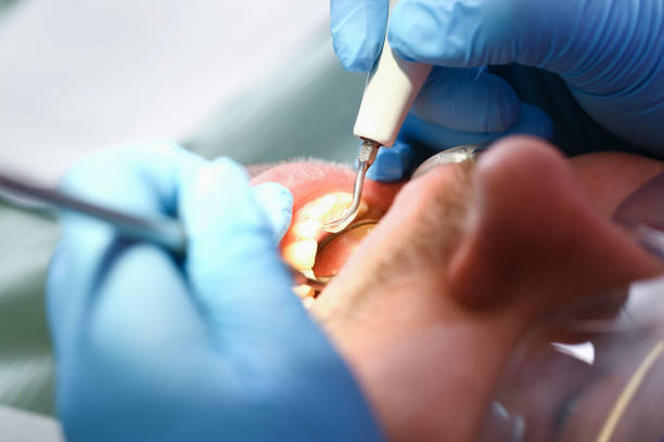 Best Walk-In Emergency Dentist in Cape Girardeau, MO